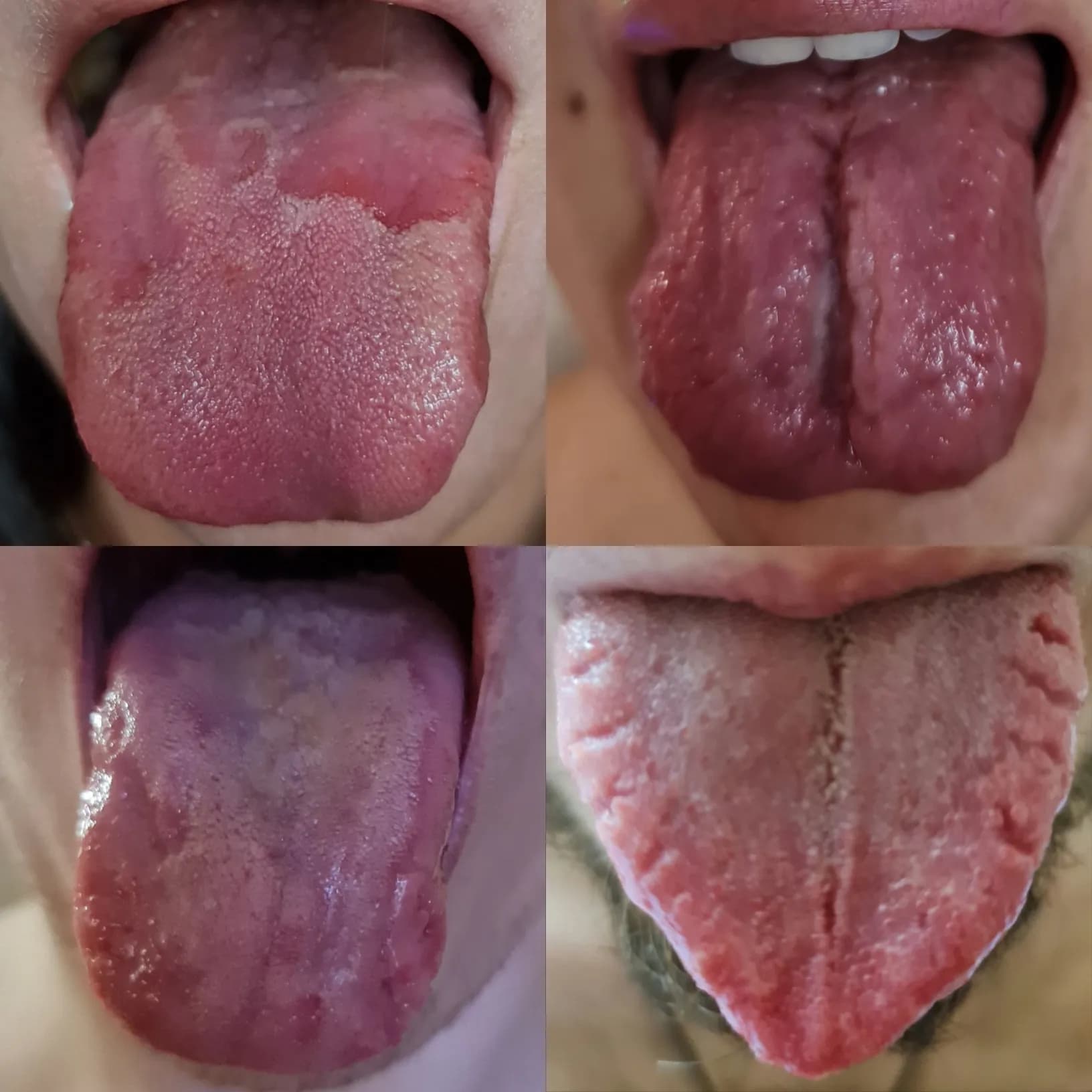 Язык
